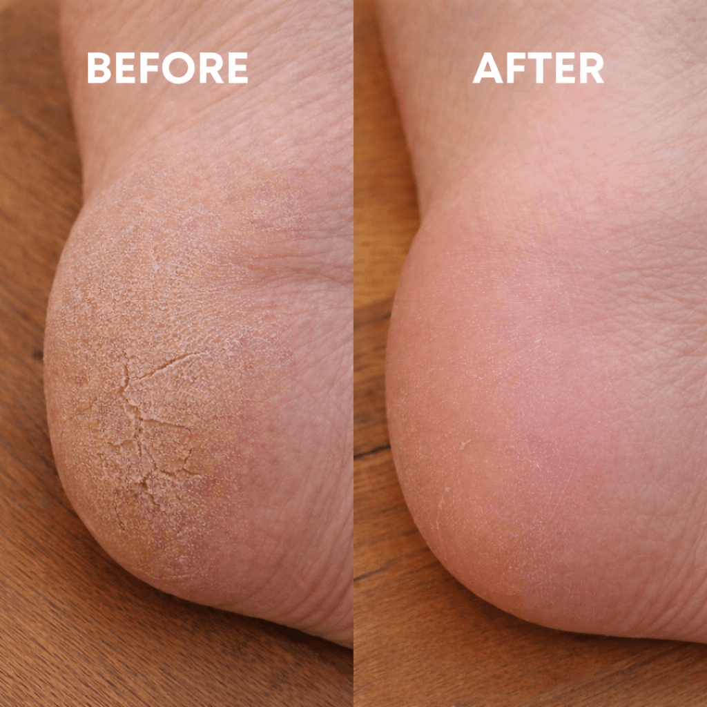 Nano Glass Miracle Foot File